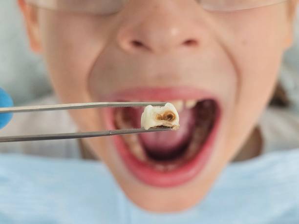 Best Emergency Orthodontic Repairs in Claryville, KY