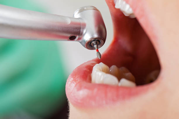 Best Walk-In Emergency Dentist in Claryville, KY